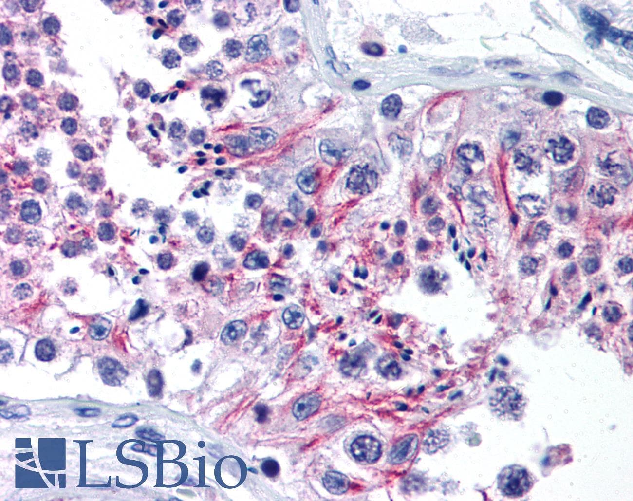 GRM6 / MGLUR6 Antibody (C-Terminus, Biotin)