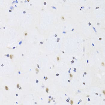 PRPF19 / PRP19 Antibody