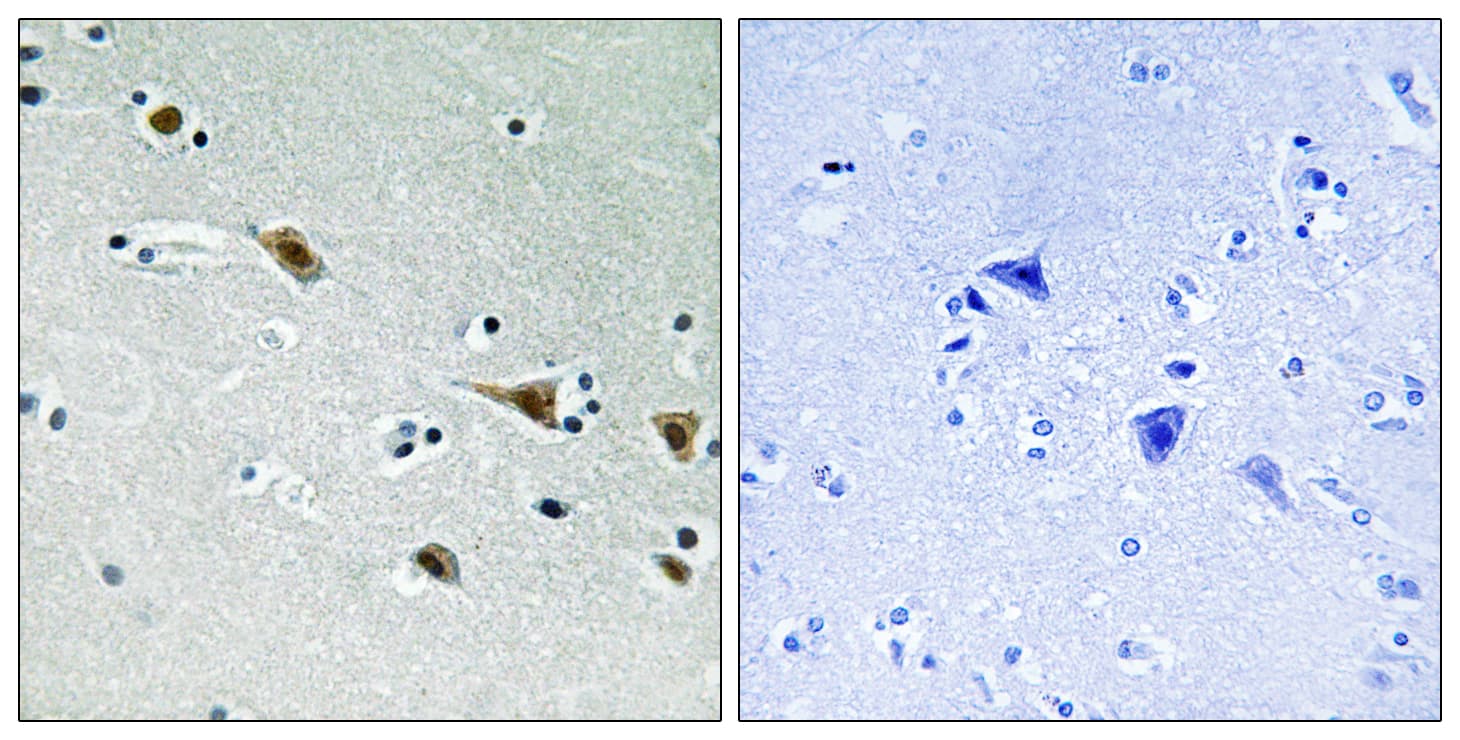 MAP2K7 / MEK7 Antibody (phospho-Ser271)