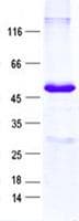 Human SNRPB / COD Protein (Recombinant GST, N-terminus + His, C-terminus)