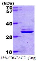 Human PSMA7 Protein (Recombinant His)