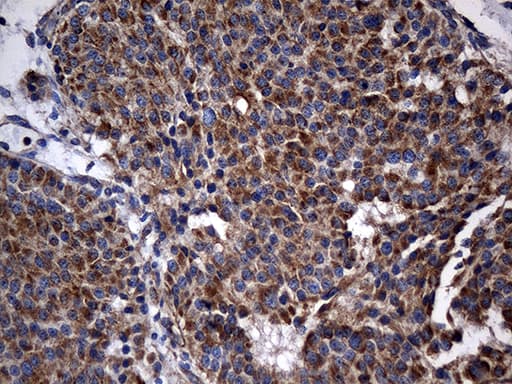 STBD1 Antibody (aa24-358, clone OTI2F1)