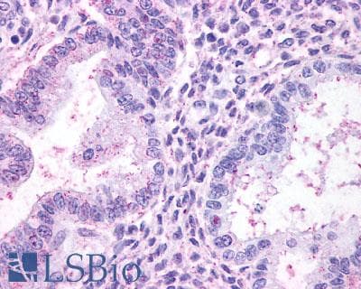 IHC-plus™ Polyclonal Rabbit anti-Human Thromboxane A2 Receptor Antibody (C-Terminus, IHC)