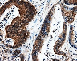Monoclonal Mouse anti-Human L1CAM Antibody (clone OTI2H5, IHC, IF, WB)