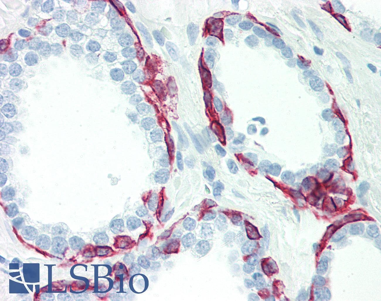 PathPlus™ KRT17 / CK17 / Cytokeratin 17 Antibody