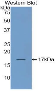 CORIN Antibody (aa521-637, PE)