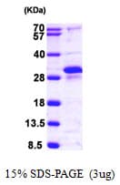 Human RERG Protein (Recombinant His)