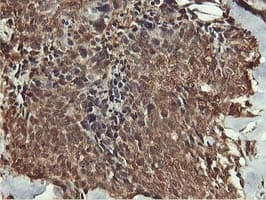 AKT1 Antibody (clone OTI4G4)