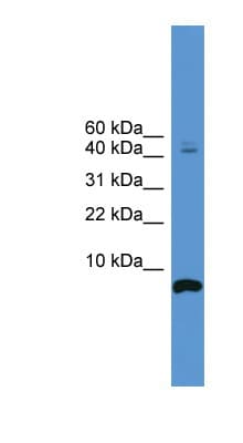 Polyclonal Rabbit anti-Human CORT / Cortistatin Antibody (N-Terminus, WB)