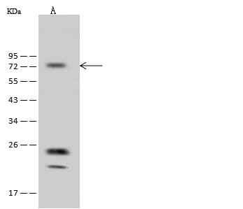 Polyclonal Rabbit anti-Human ADCK3 / CABC1 Antibody (IHC, WB)