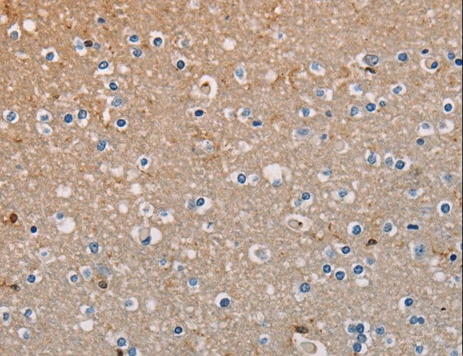 Polyclonal Rabbit anti-Human AMBRA1 Antibody (IHC)