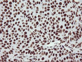 NONO / P54NRB Antibody (clone OTI3F8)