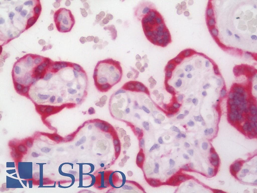 IHC-plus™ Polyclonal Rabbit anti-Human EMA / MUC1 Antibody (aa1176-1205, IHC, WB)