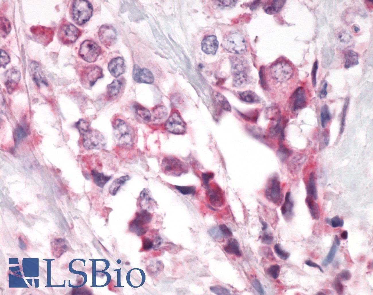 PathPlus™ Polyclonal Rabbit anti-Human PTPRA / RPTP-Alpha Antibody (Cytoplasmic Domain, IHC)