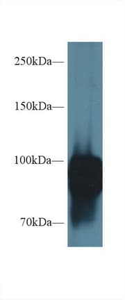 POSTN / Periostin Antibody (aa659-810)