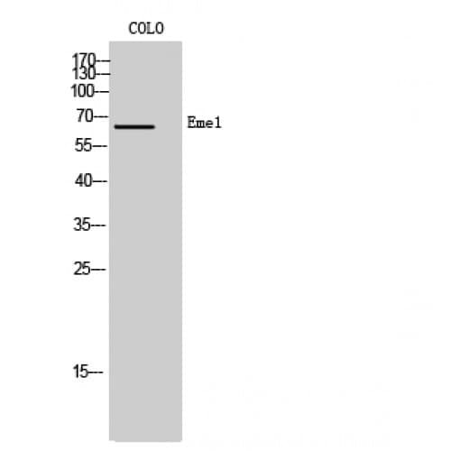 Polyclonal Rabbit anti-Human EME1 Antibody (250-330 aa, Internal, WB)