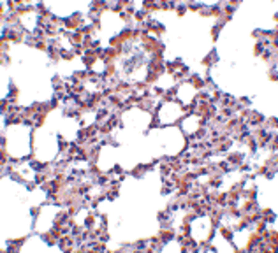 Polyclonal Rabbit anti-Human TRPC6 Antibody (IHC, IF, WB)