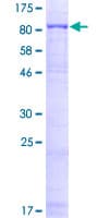 Human ARAF / ARAF1 / A-RAF Protein (Recombinant GST)