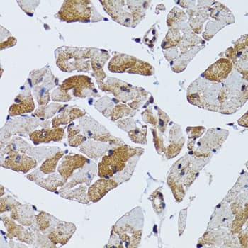 MRPS6 / MRP S6 Antibody