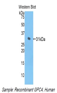 GPC4 / Glypican 4 Antibody (aa261-527)