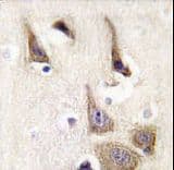 AK5 / Adenylate Kinase 5 Antibody (aa404-433)