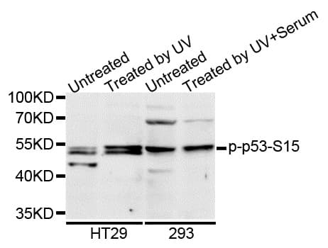 TP53 / p53 Antibody (phospho-Ser15)