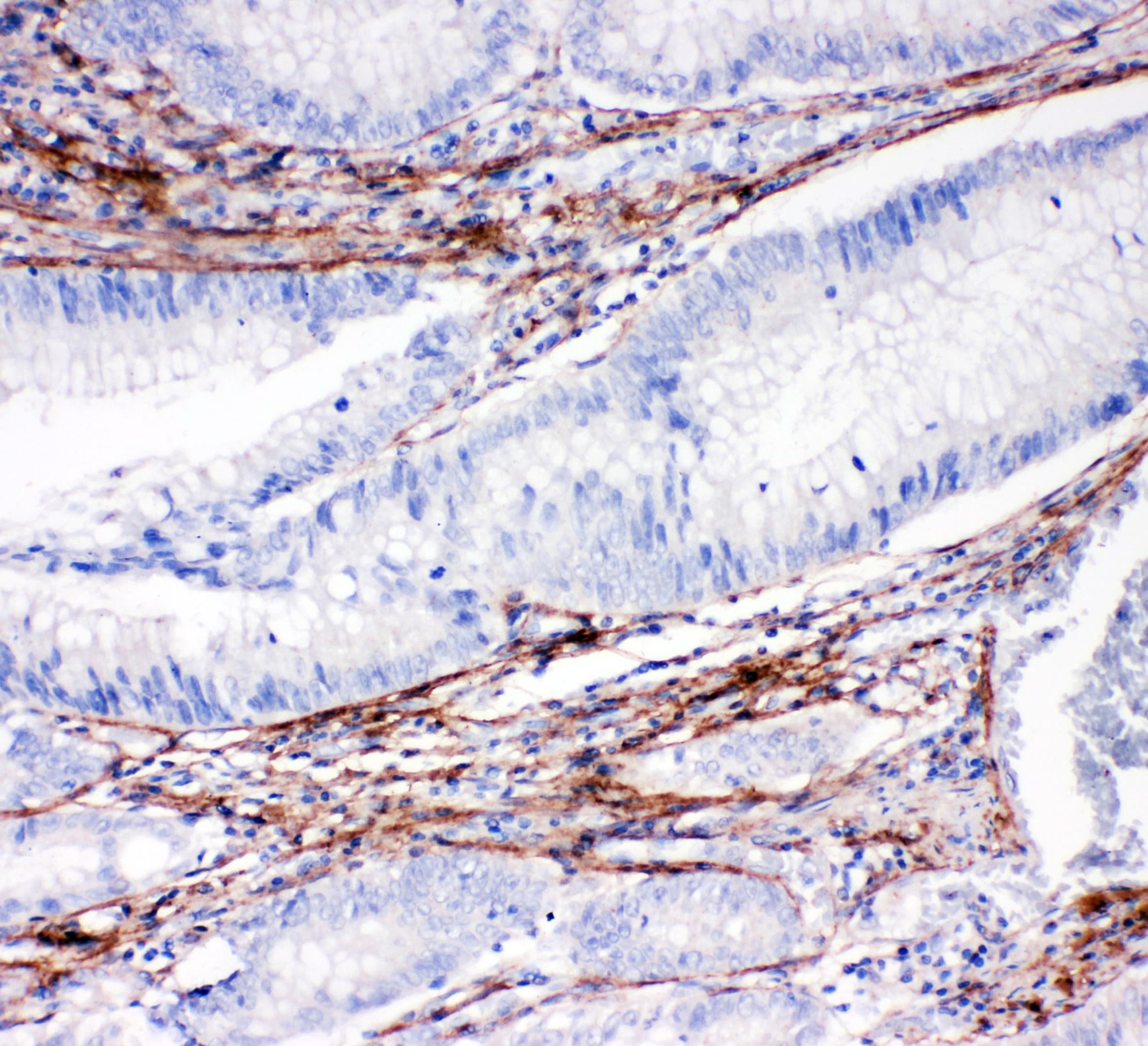 COL1A1 / Collagen I Alpha 1 Antibody (aa1192-1207)