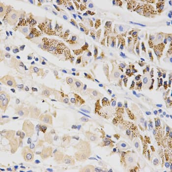 BTRCP / BETA-TRCP Antibody
