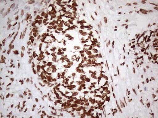 HNRNPL / hnRNP L Antibody (aa270-502, clone OTI4E5, Carrier-free)