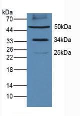CD274 / B7-H1 / PD-L1 Antibody (aa34-241)