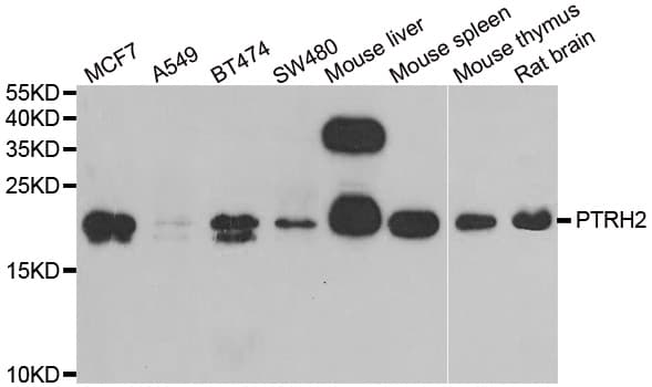 PTRH2 / BIT1 Antibody