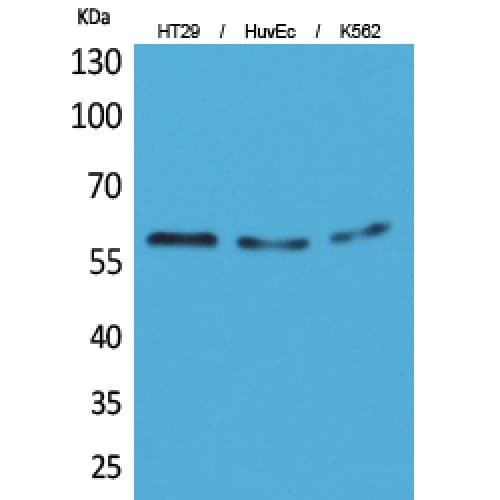 CYP11B1+2 Antibody (61-110 aa, N-terminal)