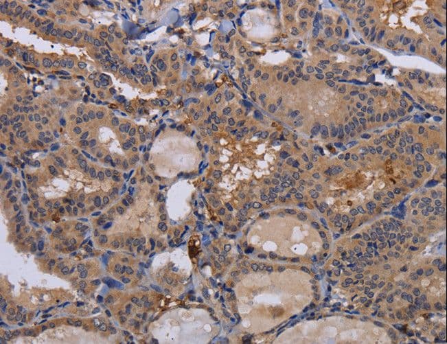 FADS1 Antibody