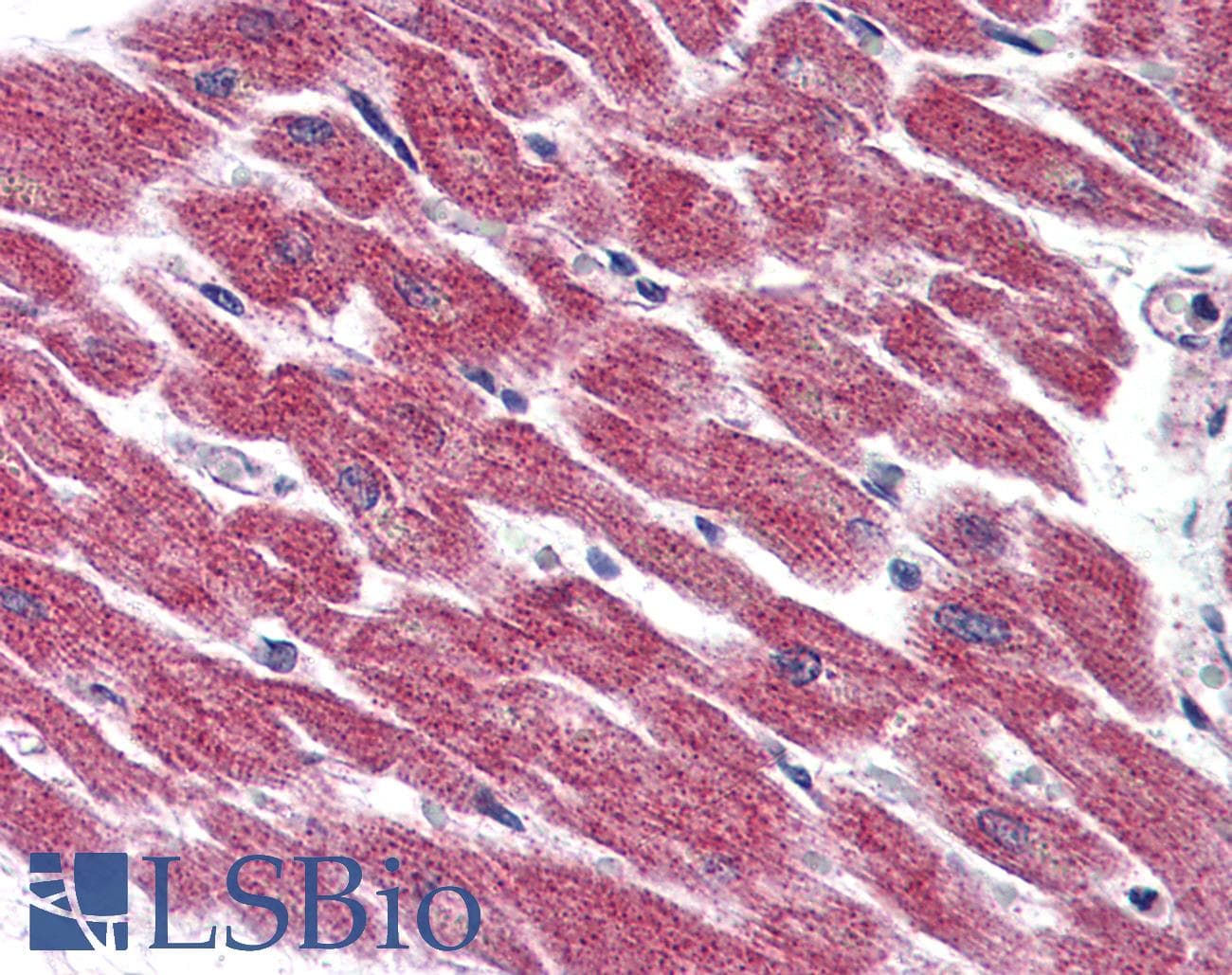IHC-plus™ Polyclonal Rabbit anti-Human ADGRF5 / GPR116 Antibody (Internal, IHC)