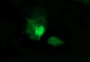 MAPK13 / p38delta Antibody (clone OTI12C12)