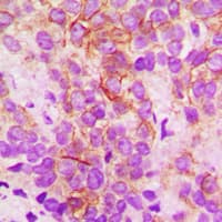 CYP2B6 Antibody (Internal)