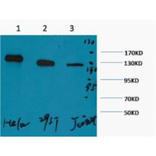 Monoclonal Mouse anti-Human PARP1 Antibody (clone M3, WB)