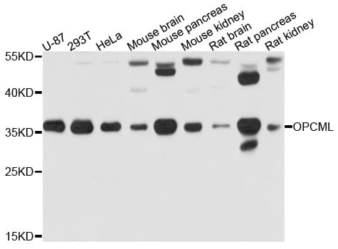 Polyclonal Rabbit anti-Human OPCML / OBCAM Antibody (WB)