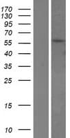 TPTE Protein (Over-Expression Lysate Myc-DDK (Flag))