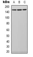 Polyclonal Rabbit anti-Human PLCB3 Antibody (C-Terminus, IHC, WB)