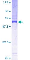 Human PDCL3 Protein (Recombinant GST)