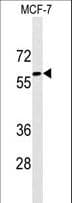 Monoclonal Mouse anti-Human Alpha-Fetoprotein Antibody (aa56-85, WB)