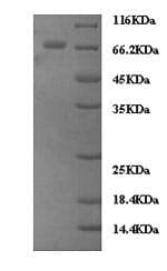 Human Zyxin Protein (Recombinant 6His, N-terminus)