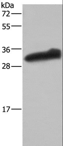 Polyclonal Rabbit anti-Human GSTA3 Antibody (IHC, WB)