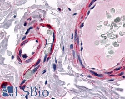 PathPlus™ Polyclonal Rabbit anti-Human CALCRL / CGRP Receptor Antibody (N-Terminus, IHC)