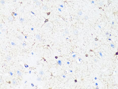Polyclonal Rabbit anti-Human TH / Tyrosine Hydroxylase Antibody (IHC, WB)
