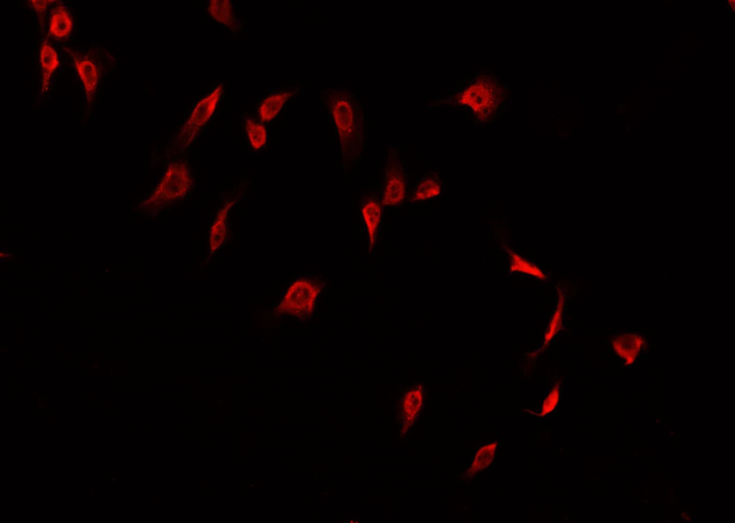 Polyclonal Rabbit anti-Human CLDN2 / Claudin 2 Antibody (IHC, IF, WB)