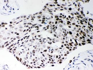 SRSF1 / SF2 Antibody