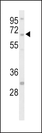 PTPN5 / STEP Antibody (aa168-198)