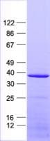 Human NDUFAF5 Protein (Recombinant His, N-Terminal)